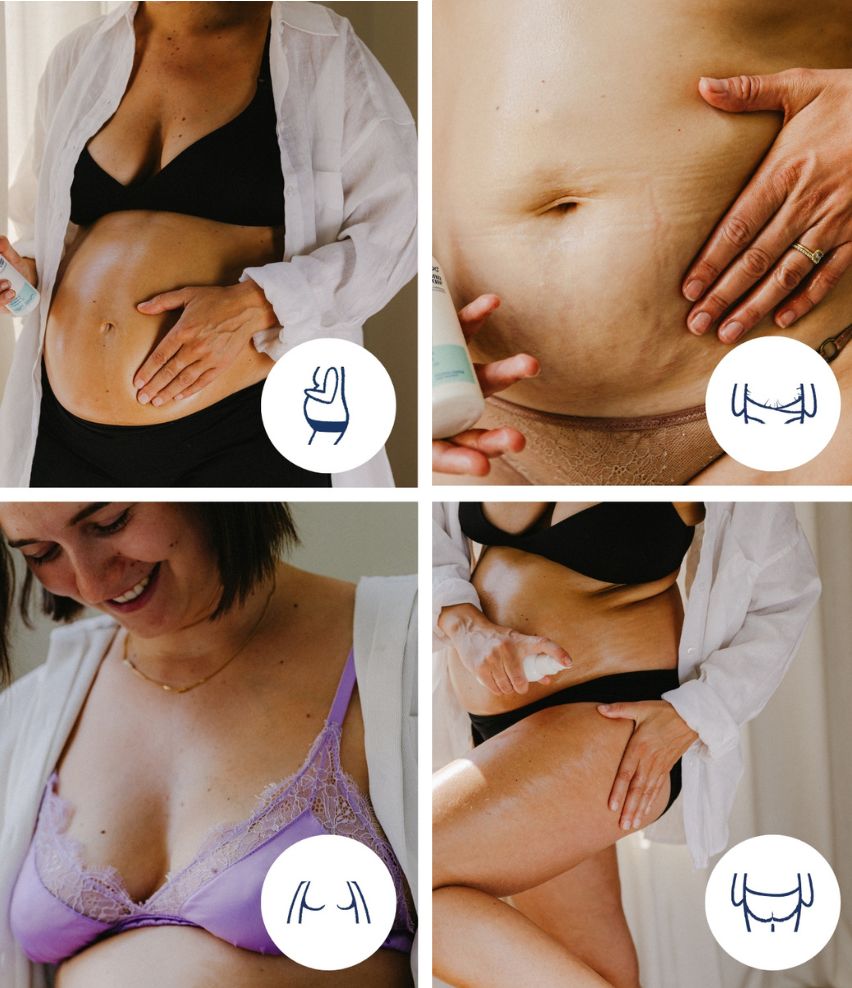 Körperöl - doomoo x shinncare für Bauch, Brust, Dehnungsstreifen, Oberschekel